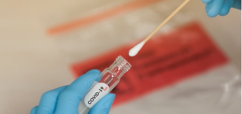 Kann ich den Corona-Test von der Steuer absetzen?